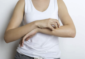 濕疹最快的自然療法是什麼？